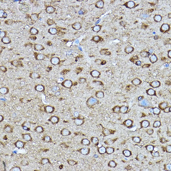 Immunohistochemistry: Rabbit Polyclonal CRMP2 Antibody - Immunohistochemistry analysis of paraffin-embedded mouse brain using [KO Validated] CRMP2/CRMP2/DPYSL2 Rabbit pAb at dilution of 1:400 (40x lens).Perform high pressure antigen retrieval with 10 mM citrate buffer pH 6.0 before commencing with IHC staining protocol.