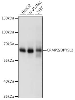 Western Blot: Rabbit Polyclonal CRMP2 Antibody [NBP2-92939] - Western blot analysis of various lysates using [KO Validated] CRMP2/DPYSL2 Rabbit pAb at 1:1000 dilution.Secondary antibody: HRP Goat Anti-Rabbit IgG (H+L) at 1:10000 dilution.Lysates/proteins: 25ug per lane.Blocking buffer: 3% nonfat dry milk in TBST.Detection: ECL Basic KitExposure time: 10s.