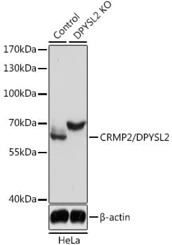 <b>Genetic Strategies Validation. </b>Western Blot: Rabbit Polyclonal CRMP2 Antibody [NBP2-92939] - Western blot analysis of lysates from wild type (WT) and CRMP2/CRMP2/DPYSL2 knockout (KO) HeLa cells, using [KO Validated] CRMP2/DPYSL2 Rabbit pAb at 1:3000 dilution.Secondary antibody: HRP Goat Anti-Rabbit IgG (H+L) at 1:10000 dilution.Lysates/proteins: 25μg per lane.Blocking buffer: 3% nonfat dry milk in TBST.Detection: ECL Basic KitExposure time: 5s.