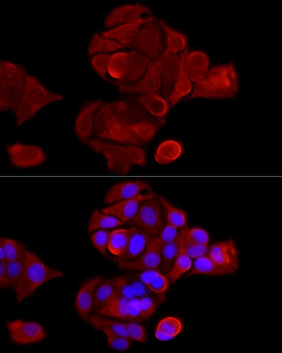 Immunocytochemistry/ Immunofluorescence: Cytokeratin 8 Antibody - Azide and BSA Free [NBP2-92958] - Immunofluorescence analysis of MCF7 cells using Cytokeratin 8 Rabbit pAb  at dilution of 1:300 (40x lens). Secondary antibody: Cy3 Goat Anti-Rabbit IgG (H+L)  at 1:500 dilution. Blue: DAPI for nuclear staining.