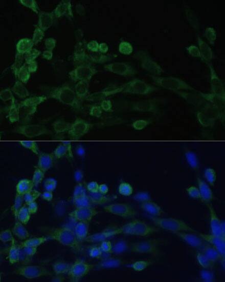 Immunocytochemistry/ Immunofluorescence: EEF1B2 Antibody - BSA Free [NBP2-92964] - Immunofluorescence analysis of NIH/3T3 cells using [KO Validated] EEF1B2 Rabbit pAb  at dilution of 1:100. Secondary antibody: Cy3 Goat Anti-Rabbit IgG (H+L)  at 1:500 dilution. Blue: DAPI for nuclear staining.