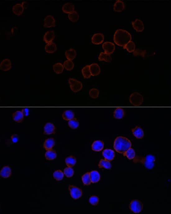 Immunocytochemistry/ Immunofluorescence: CD11b Antibody - Azide and BSA Free [NBP2-92978] - Immunofluorescence analysis of TF-1 cells using CD11b Rabbit pAb  at dilution of 1:100 (40x lens). Secondary antibody: Cy3-conjugated Goat anti-Rabbit IgG (H+L)  at 1:500 dilution. Blue: DAPI for nuclear staining.