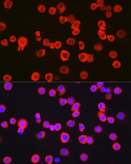 Immunocytochemistry/ Immunofluorescence: CD11b Antibody - Azide and BSA Free [NBP2-92978] - Immunofluorescence analysis of THP-1 cells using CD11b Rabbit pAb  at dilution of 1:100 (40x lens). Secondary antibody: Cy3-conjugated Goat anti-Rabbit IgG (H+L)  at 1:500 dilution. Blue: DAPI for nuclear staining.