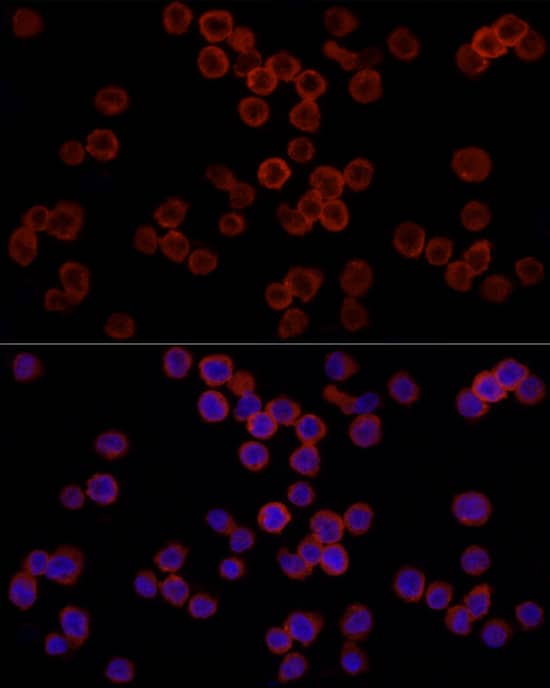 Immunocytochemistry/ Immunofluorescence: CD11b Antibody - Azide and BSA Free [NBP2-92978] - Immunofluorescence analysis of THP-1 cells using CD11b Rabbit pAb  at dilution of 1:100 (40x lens). Secondary antibody: Cy3-conjugated Goat anti-Rabbit IgG (H+L)  at 1:500 dilution. Blue: DAPI for nuclear staining.