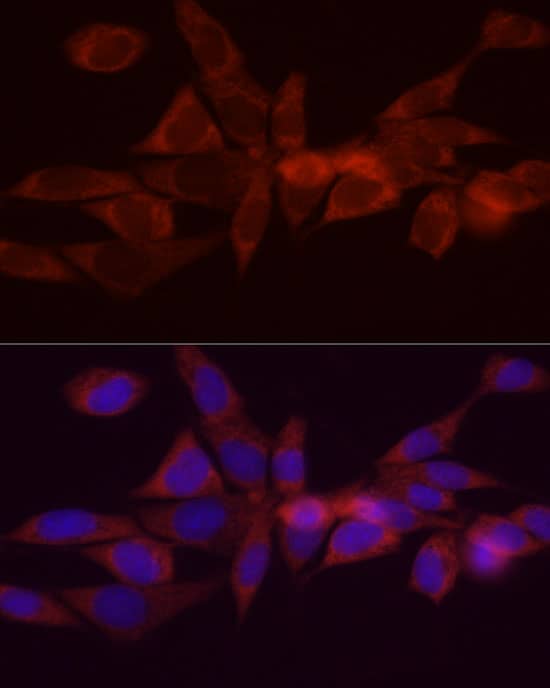 Immunocytochemistry/ Immunofluorescence: DGAT1 Antibody - BSA Free [NBP2-92984] - Immunofluorescence analysis of NIH/3T3 cells using DGAT1 Rabbit pAb  at dilution of 1:200 (40x lens). Secondary antibody: Cy3-conjugated Goat anti-Rabbit IgG (H+L)  at 1:500 dilution. Blue: DAPI for nuclear staining.