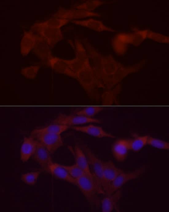 Immunocytochemistry/ Immunofluorescence: DGAT1 Antibody - BSA Free [NBP2-92984] - Immunofluorescence analysis of PC-12 cells using DGAT1 Rabbit pAb  at dilution of 1:200 (40x lens). Secondary antibody: Cy3-conjugated Goat anti-Rabbit IgG (H+L)  at 1:500 dilution. Blue: DAPI for nuclear staining.