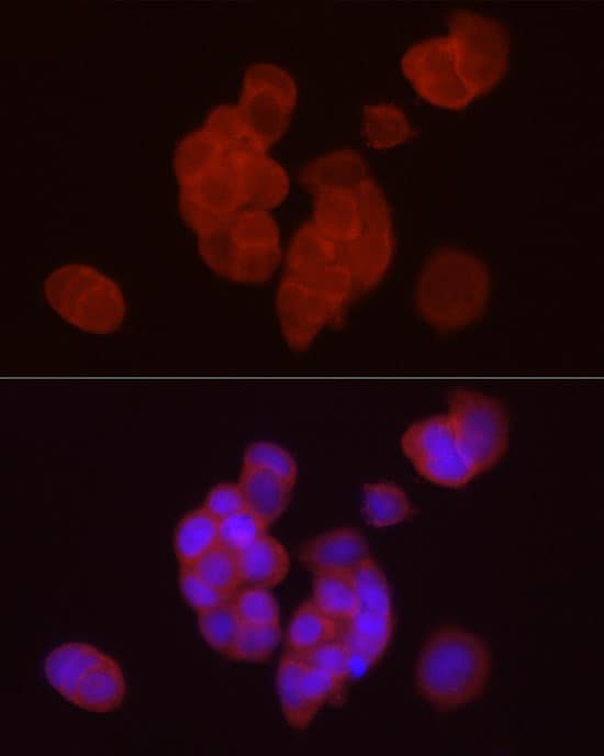 Immunocytochemistry/ Immunofluorescence: DGAT1 Antibody - BSA Free [NBP2-92984] - Immunofluorescence analysis of MCF7 cells using DGAT1 Rabbit pAb  at dilution of 1:200 (40x lens). Secondary antibody: Cy3-conjugated Goat anti-Rabbit IgG (H+L)  at 1:500 dilution. Blue: DAPI for nuclear staining.