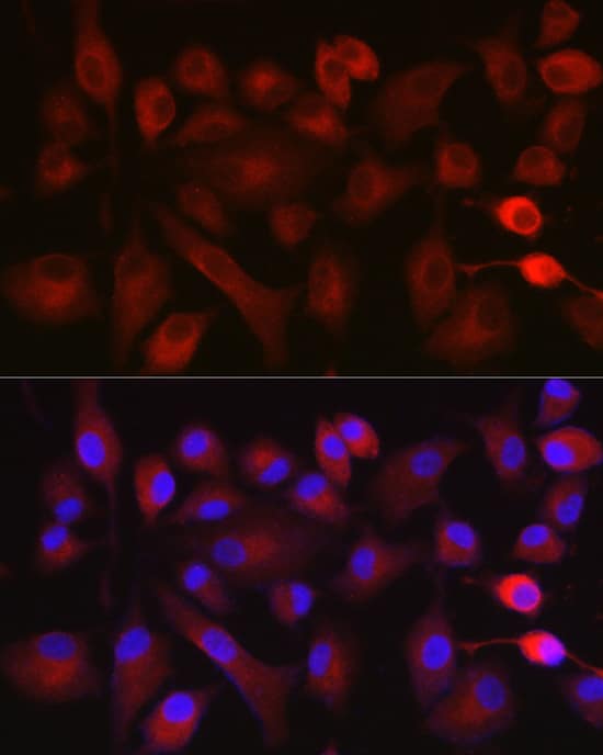 Immunocytochemistry/ Immunofluorescence: NOX5 Antibody - Azide and BSA Free [NBP2-93004] - Immunofluorescence analysis of A-549 cells using NOX5 Rabbit pAb  at dilution of 1:100 (40x lens). Secondary antibody: Cy3-conjugated Goat anti-Rabbit IgG (H+L)  at 1:500 dilution. Blue: DAPI for nuclear staining.
