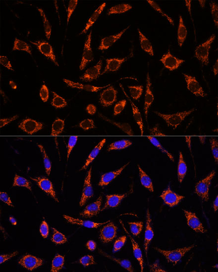 Immunocytochemistry/ Immunofluorescence: XK X-linked Kx blood group Antibody - Azide and BSA Free [NBP2-93011] - Immunofluorescence analysis of L929 cells using XK X-linked Kx blood group Rabbit pAb  at dilution of 1:100. Secondary antibody: Cy3 Goat Anti-Rabbit IgG (H+L)  at 1:500 dilution. Blue: DAPI for nuclear staining.