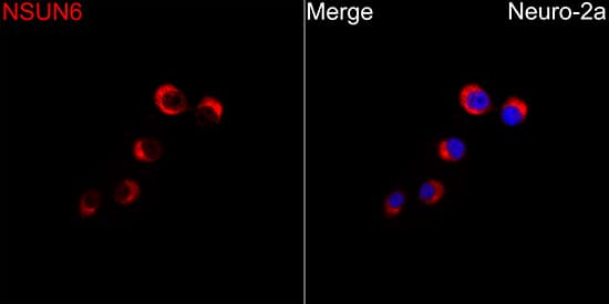 Immunocytochemistry/ Immunofluorescence: NSUN6 Antibody - BSA Free [NBP2-93013] - Immunofluorescence analysis of Neuro-2a cells using NSUN6 Rabbit pAb at a dilution of 1:100 (40x lens). Secondary antibody:Cy3 Goat Anti-Rabbit IgG (H+L) at 1:500 dilution. Blue: DAPI for nuclear staining.