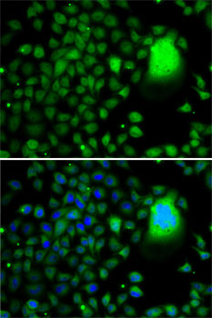 Immunocytochemistry/ Immunofluorescence: TAF5 Antibody - BSA Free [NBP2-93025] - Immunofluorescence analysis of A-549 cells using TAF5 antibody . Blue: DAPI for nuclear staining.