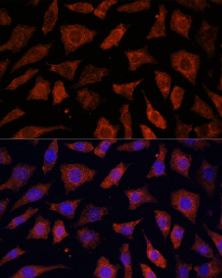 Immunocytochemistry/ Immunofluorescence PDE6G Antibody - Azide and BSA Free