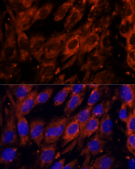 Immunocytochemistry/ Immunofluorescence: PDE6G Antibody - Azide and BSA Free [NBP2-93029] - Immunofluorescence analysis of C6 cells using PDE6G Rabbit pAb  at dilution of 1:100. Secondary antibody: Cy3 Goat Anti-Rabbit IgG (H+L)  at 1:500 dilution. Blue: DAPI for nuclear staining.