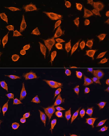 Immunocytochemistry/ Immunofluorescence RPS28 Antibody - Azide and BSA Free