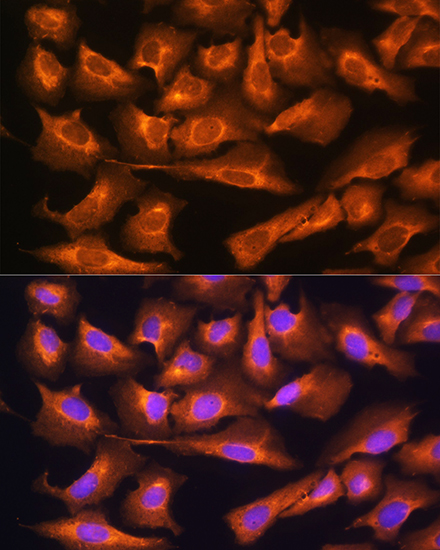 Immunocytochemistry/ Immunofluorescence RPS28 Antibody - Azide and BSA Free