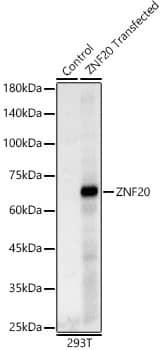 Western Blot ZNF20 Antibody - BSA Free