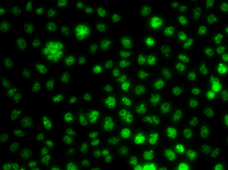 Immunocytochemistry/ Immunofluorescence: UBE2R2 Antibody - BSA Free [NBP2-93070] - Immunofluorescence analysis of A549 cells using UBE2R2 antibody .