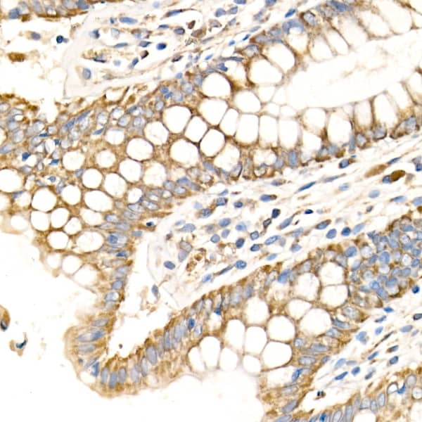 Immunohistochemistry: MT-CO2 Antibody - Azide and BSA Free [NBP2-93084] - Immunohistochemistry analysis of paraffin-embedded Human colon using MT-CO2 Rabbit pAb  at dilution of 1:100 (40x lens). High pressure antigen retrieval performed with 0.01M Citrate Bufferr (pH 6.0) prior to IHC staining.