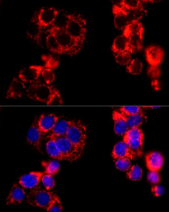Immunocytochemistry/ Immunofluorescence: MT-CO2 Antibody - Azide and BSA Free [NBP2-93084] - Immunofluorescence analysis of HepG2 cells using MT-CO2 Rabbit pAb  at dilution of 1:100 (40x lens). Secondary antibody: Cy3-conjugated Goat anti-Rabbit IgG (H+L)  at 1:500 dilution. Blue: DAPI for nuclear staining.