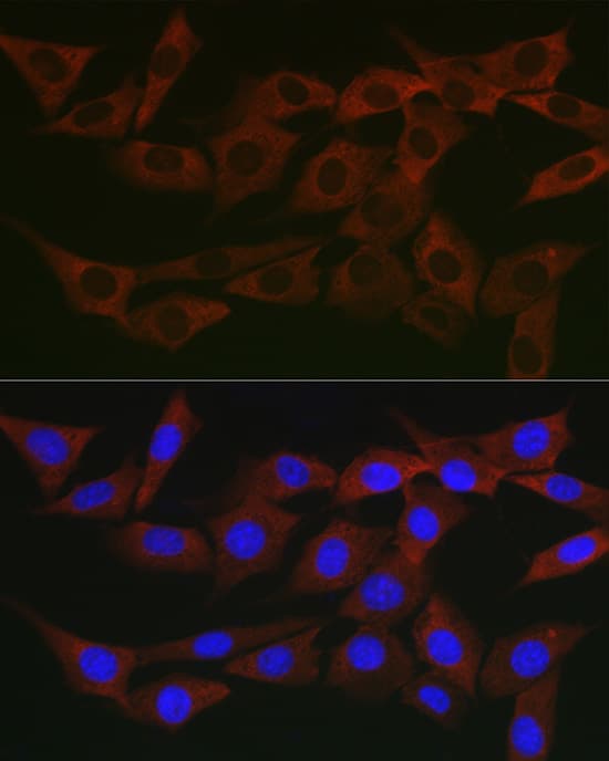 Immunocytochemistry/ Immunofluorescence WNK3 Antibody - Azide and BSA Free