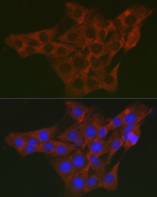 Immunocytochemistry/ Immunofluorescence: WNK3 Antibody - Azide and BSA Free [NBP2-93100] - Immunofluorescence analysis of PC-12 cells using WNK3 Rabbit pAb  at dilution of 1:200 (40x lens). Secondary antibody: Cy3-conjugated Goat anti-Rabbit IgG (H+L)  at 1:500 dilution. Blue: DAPI for nuclear staining.