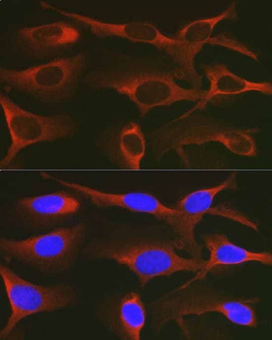 Immunocytochemistry/ Immunofluorescence WNK3 Antibody - Azide and BSA Free