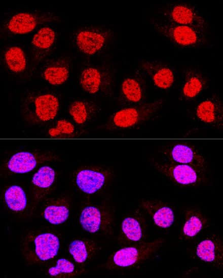 Immunocytochemistry/ Immunofluorescence: TEAD3 Antibody - BSA Free [NBP2-93128] - Confocal immunofluorescence analysis of U-2 OS cells using TEAD3 Rabbit pAb  at dilution of 1:400. Blue: DAPI for nuclear staining.