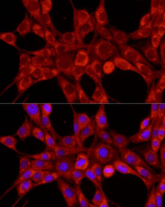 Immunocytochemistry/ Immunofluorescence: TIMM23 Antibody - Azide and BSA Free [NBP2-93133] - Immunofluorescence analysis of NIH/3T3 cells using TIMM23 Rabbit pAb  at dilution of 1:100 (40x lens). Secondary antibody: Cy3-conjugated Goat anti-Rabbit IgG (H+L)  at 1:500 dilution. Blue: DAPI for nuclear staining.