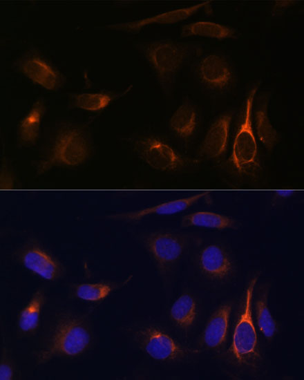 Immunocytochemistry/ Immunofluorescence: TMEM49 Antibody - Azide and BSA Free [NBP2-93149] - Immunofluorescence analysis of U-2 OS cells using TMEM49 Rabbit pAb  at dilution of 1:100 (40x lens). Secondary antibody: Cy3 Goat Anti-Rabbit IgG (H+L)  at 1:500 dilution. Blue: DAPI for nuclear staining.