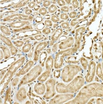 Immunohistochemistry-Paraffin: Virilizer Antibody [NBP2-93159] -  Mouse kidney using KIAA1429 Rabbit pAb at dilution of 1:200 (40x lens).Perform high pressure antigen retrieval with 10 mM citrate buffer pH 6.0 before commencing with IHC staining protocol.