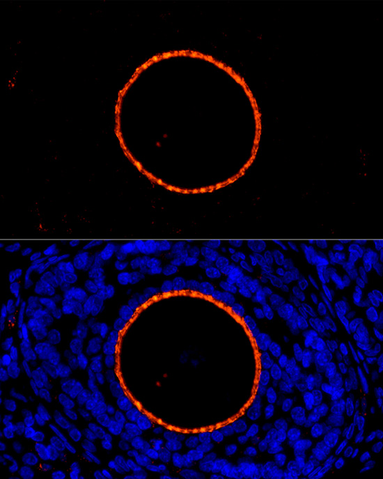 Immunocytochemistry/ Immunofluorescence ZP2 Antibody - BSA Free