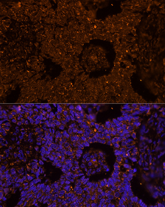 Immunocytochemistry/ Immunofluorescence ZP2 Antibody - BSA Free
