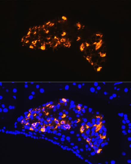 Immunocytochemistry/ Immunofluorescence: Somatostatin Antibody - Azide and BSA Free [NBP2-93171] - Immunofluorescence analysis of paraffin-embedded rat pancreas using Somatostatin Rabbit pAb  at dilution of 1:100 (40x lens). Secondary antibody: Cy3-conjugated Goat anti-Rabbit IgG (H+L)  at 1:500 dilution. Blue: DAPI for nuclear staining.