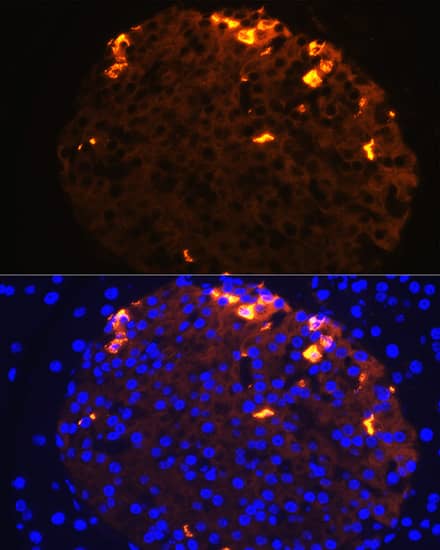 Immunocytochemistry/ Immunofluorescence: Somatostatin Antibody - Azide and BSA Free [NBP2-93171] - Immunofluorescence analysis of paraffin-embedded mouse pancreas using Somatostatin Rabbit pAb  at dilution of 1:100 (40x lens). Secondary antibody: Cy3-conjugated Goat anti-Rabbit IgG (H+L)  at 1:500 dilution. Blue: DAPI for nuclear staining.