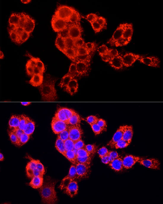 Immunocytochemistry/ Immunofluorescence: SEC31A Antibody - Azide and BSA Free [NBP2-93172] - Immunofluorescence analysis of HepG2 cells using SEC31A Rabbit pAb  at dilution of 1:100 (40x lens). Secondary antibody: Cy3 Goat Anti-Rabbit IgG (H+L)  at 1:500 dilution. Blue: DAPI for nuclear staining.