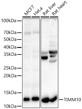 Western Blot: TIMM10 Antibody - BSA Free [NBP2-93176] - Western blot analysis of various lysates, using TIMM10 Rabbit pAb  at 1:2000 dilution.Secondary antibody: HRP Goat Anti-Rabbit IgG (H+L)  at 1:10000 dilution.Lysates/proteins: 25ug per lane.Blocking buffer: 3% nonfat dry milk in TBST.Detection: ECL Basic Kit.Exposure time: 30s.