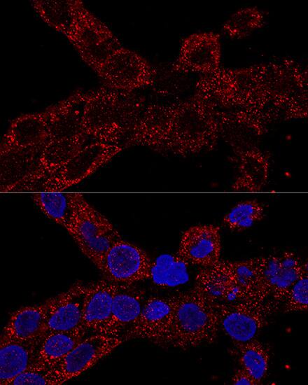 Immunocytochemistry/ Immunofluorescence: RPL21 Antibody - Azide and BSA Free [NBP2-93190] - Confocal immunofluorescence analysis of A-431 cells using RPL21 Rabbit pAb  at dilution of 1:100. Blue: DAPI for nuclear staining.