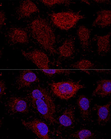 Immunocytochemistry/ Immunofluorescence: RPL21 Antibody - Azide and BSA Free [NBP2-93190] - Confocal immunofluorescence analysis of HeLa cells using RPL21 Rabbit pAb  at dilution of 1:200. Blue: DAPI for nuclear staining.