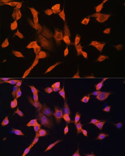 Immunocytochemistry/ Immunofluorescence: Protein Kinase A regulatory subunit I alpha Antibody - Azide and BSA Free [NBP2-93193] - Immunofluorescence analysis of NIH/3T3 cells using Protein Kinase A regulatory subunit I alpha Rabbit pAb  at dilution of 1:100. Secondary antibody: Cy3-conjugated Goat anti-Rabbit IgG (H+L)  at 1:500 dilution. Blue: DAPI for nuclear staining.