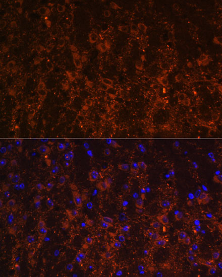 Immunocytochemistry/ Immunofluorescence SNX13 Antibody - Azide and BSA Free
