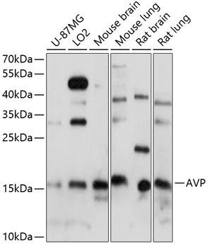 Western Blot: Antidiuretic Hormone Antibody - Azide and BSA Free [NBP2-93197] - Western blot analysis of various lysates using Antidiuretic Hormone Rabbit pAb  at 1:1000 dilution.Secondary antibody: HRP Goat Anti-Rabbit IgG (H+L)  at 1:10000 dilution.Lysates/proteins: 25ug per lane.Blocking buffer: 3% nonfat dry milk in TBST.Detection: ECL Basic Kit.Exposure time: 60s.