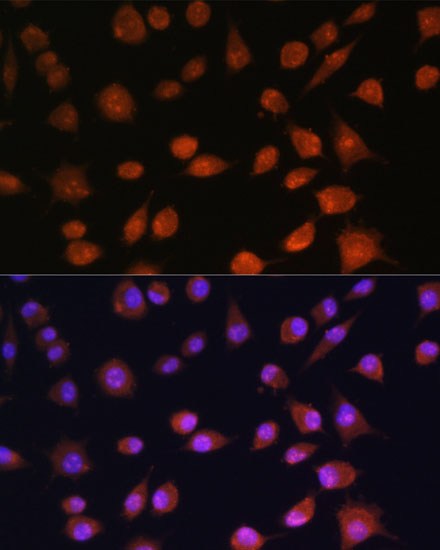 Immunocytochemistry/ Immunofluorescence: RPS19BP1 Antibody - Azide and BSA Free [NBP2-93262] - Immunofluorescence analysis of L929 cells using RPS19BP1 Rabbit pAb  at dilution of 1:100. Secondary antibody: Cy3 Goat Anti-Rabbit IgG (H+L)  at 1:500 dilution. Blue: DAPI for nuclear staining.