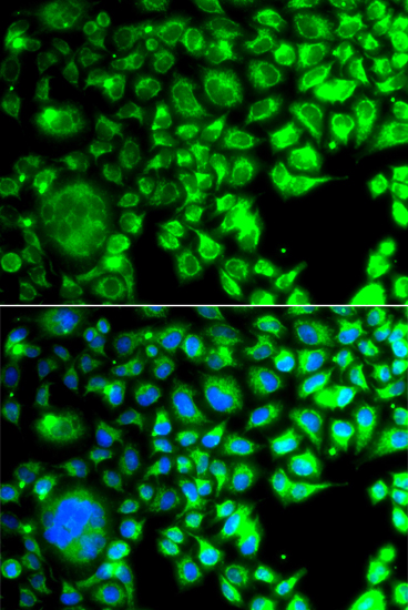 Immunocytochemistry/ Immunofluorescence: TBP like protein TLP Antibody - BSA Free [NBP2-93267] - Immunofluorescence analysis of A549 cells using TBP like protein TLP antibody . Blue: DAPI for nuclear staining.