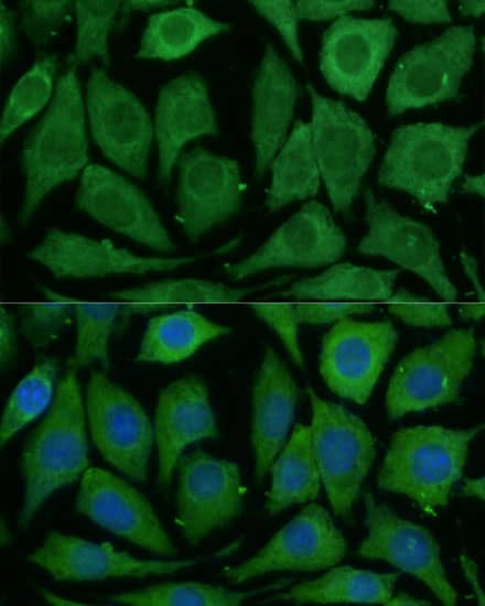 Immunocytochemistry/ Immunofluorescence: SARDH Antibody - Azide and BSA Free [NBP2-93295] - Immunofluorescence analysis of L929 cells using SARDH Rabbit pAb  at dilution of 1:100 (40x lens). Secondary antibody: Cy3-conjugated Goat anti-Rabbit IgG (H+L)  at 1:500 dilution. Blue: DAPI for nuclear staining.