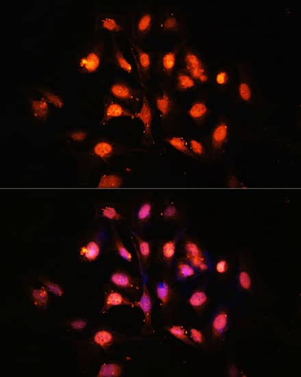 Immunocytochemistry/ Immunofluorescence: PHLPP Antibody - Azide and BSA Free [NBP2-93296] - Immunofluorescence analysis of U-2 OS cells using PHLPP Rabbit pAb  at dilution of 1:100 (40x lens). Secondary antibody: Cy3-conjugated Goat anti-Rabbit IgG (H+L)  at 1:500 dilution. Blue: DAPI for nuclear staining.