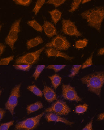 Immunocytochemistry/ Immunofluorescence Prolyl endopeptidase-like Antibody - Azide and BSA Free