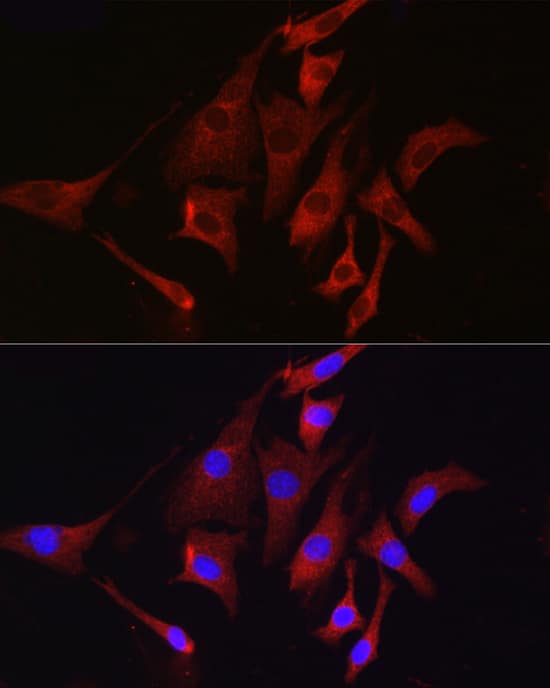 Immunocytochemistry/ Immunofluorescence: TMPRSS2 Antibody - Azide and BSA Free [NBP2-93322] - Immunofluorescence analysis of NIH/3T3 cells using TMPRSS2 Rabbit pAb  at dilution of 1:50 (40x lens). Secondary antibody: Cy3-conjugated Goat anti-Rabbit IgG (H+L)  at 1:500 dilution. Blue: DAPI for nuclear staining.