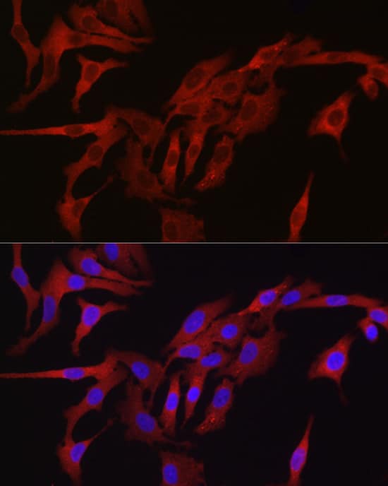 Immunocytochemistry/ Immunofluorescence: TMPRSS2 Antibody - Azide and BSA Free [NBP2-93322] - Immunofluorescence analysis of A-549 cells using TMPRSS2 Rabbit pAb  at dilution of 1:50 (40x lens). Secondary antibody: Cy3-conjugated Goat anti-Rabbit IgG (H+L)  at 1:500 dilution. Blue: DAPI for nuclear staining.