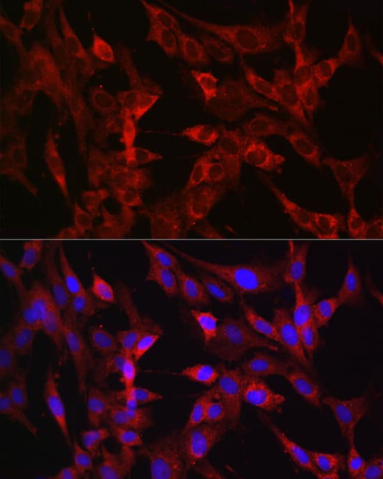 Immunocytochemistry/ Immunofluorescence: TMPRSS2 Antibody - Azide and BSA Free [NBP2-93322] - Immunofluorescence analysis of C6 cells using TMPRSS2 Rabbit pAb  at dilution of 1:50 (40x lens). Secondary antibody: Cy3-conjugated Goat anti-Rabbit IgG (H+L)  at 1:500 dilution. Blue: DAPI for nuclear staining.