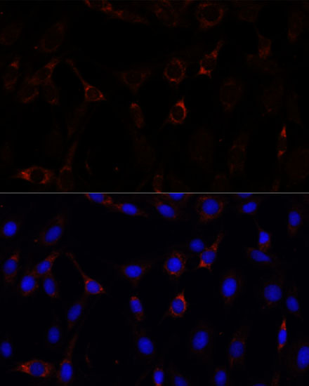 Immunocytochemistry/ Immunofluorescence: ZNF179 Antibody - Azide and BSA Free [NBP2-93335] - Immunofluorescence analysis of C6 cells using ZNF179 Rabbit pAb  at dilution of 1:100. Secondary antibody: Cy3 Goat Anti-Rabbit IgG (H+L)  at 1:500 dilution. Blue: DAPI for nuclear staining.